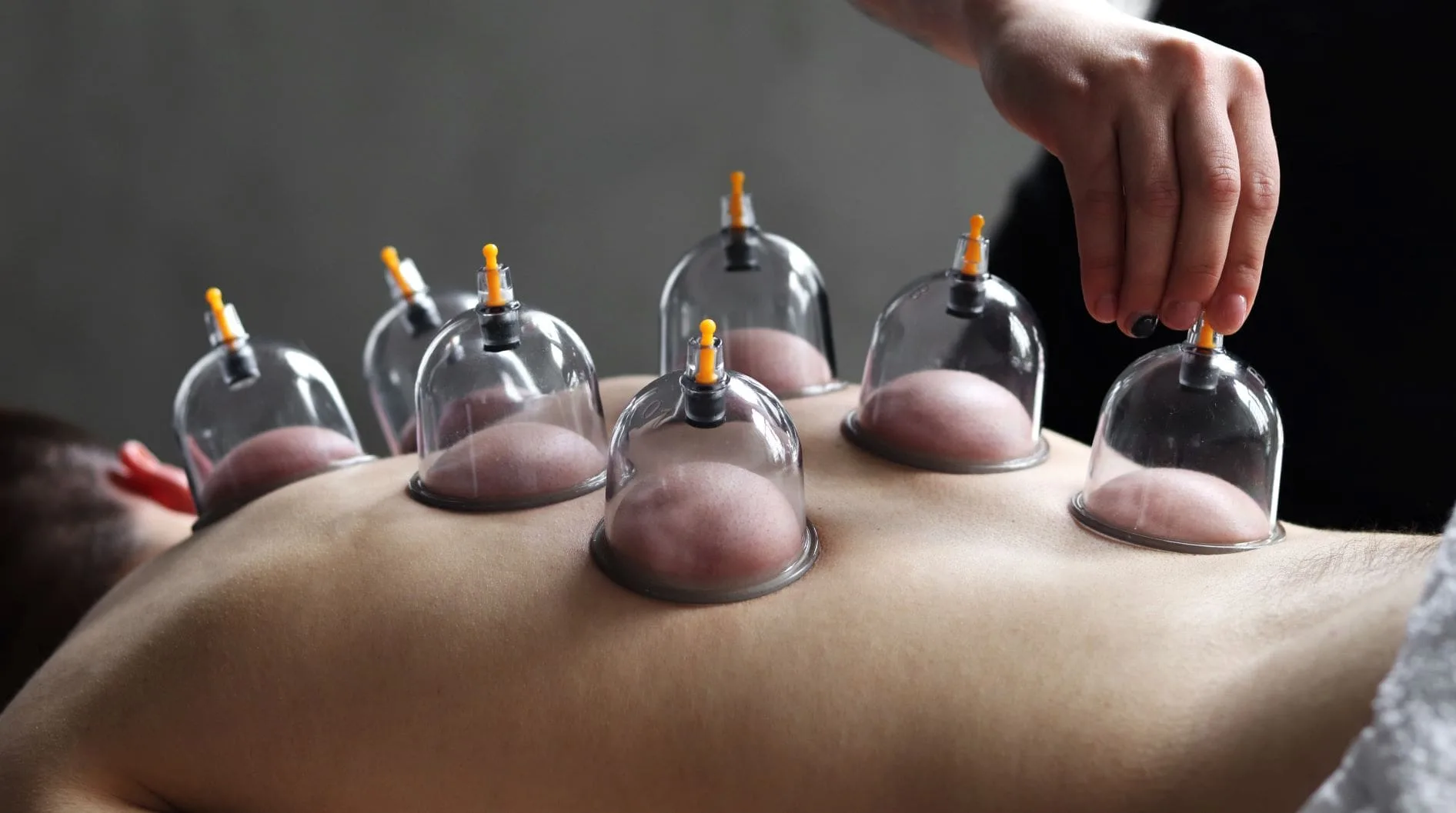 8 Session Package Cupping - 45 Minutes Each